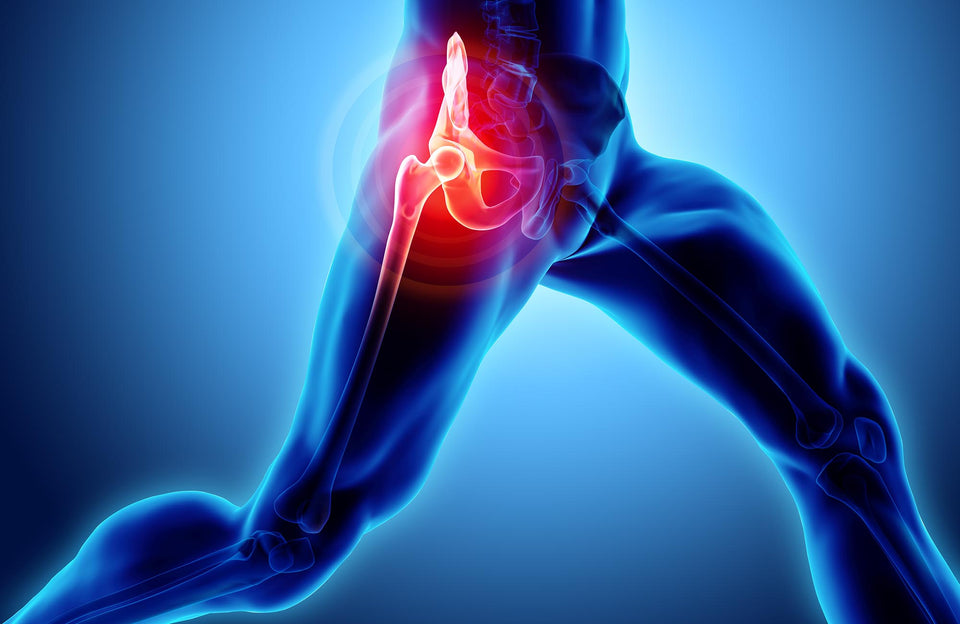股関節の痛みの原因は？ランニング初心者へおすすめの痛み対策と予防方法